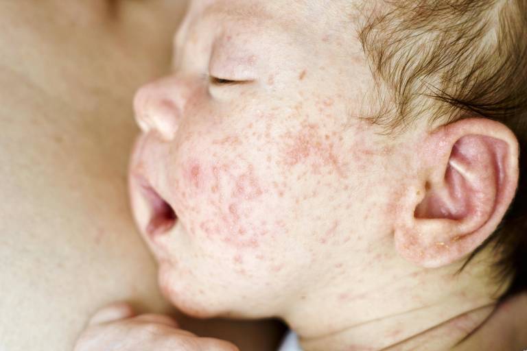 Neugeborenes Baby aus Klinik entführt! Frau nimmt Kind einfach mit